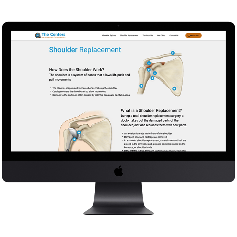 Shoulder-Replacement02-min