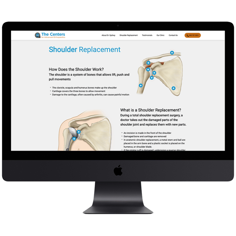 Shoulder-Replacement02-min